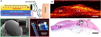 Optically Generated Ultrasound for Intracoronary Imaging